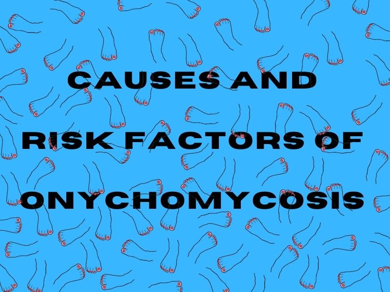 Causes and Risk Factors of Onychomycosis
